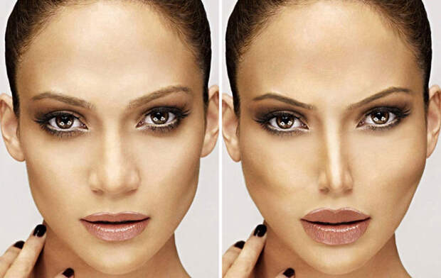 Так изменилась бы внешность известной певицы и актрисы Дженнифер Лопес (Jennifer Lopez), если бы она прибегла к услугам пластического хирурга.