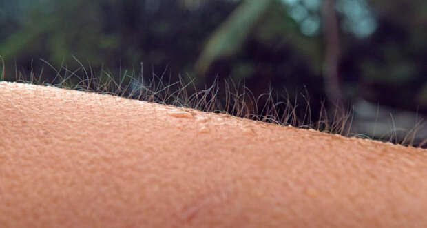 goose bumps