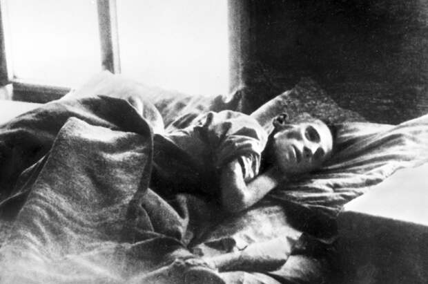 Человек, спасенный от голодной смерти. Поволжье, 1921 год.