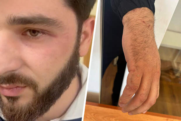 Омбудсмен Ставрополья потребовал проверить жалобу на пытки в полиции