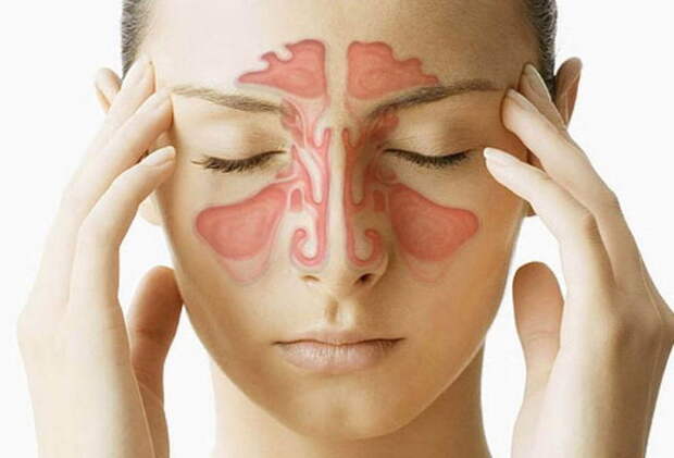 Заложенность носа без насморка: без кашля и температуры, при простуде, при  гайморите, причины и лечение, какие капли лучше, чем промывать