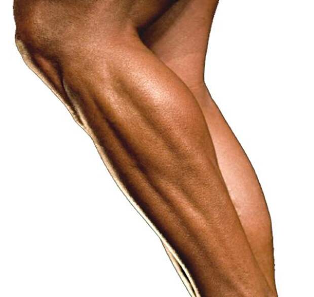 Сводит мышцы ног. Судорога икроножной мышцы.