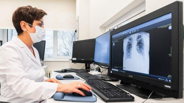 ИИ-сервис для контроля качества рентгенографии грудной клетки разработали в Москве