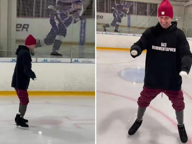 СМИ: Костомаров пожалел, что согласился на ампутацию