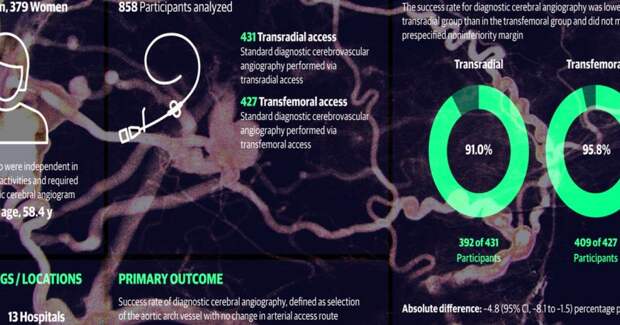 Бедренный доступ превзошел лучевой при ангиографии мозговых сосудов
