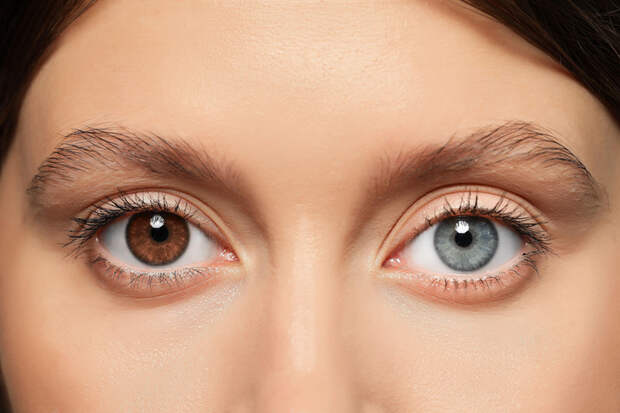 Глаза разных цветов — опасно ли это? Объясняют офтальмологи