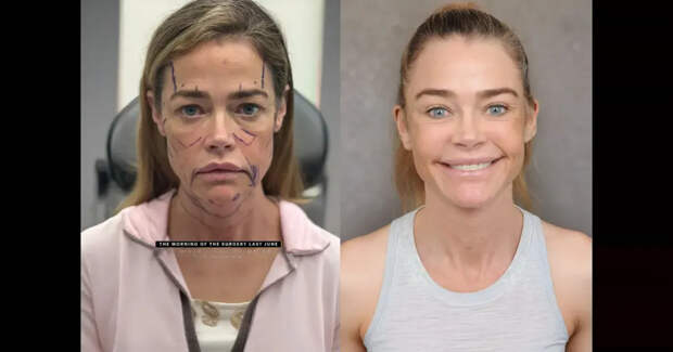 "Выглядит на 15 лет моложе". В сети обсуждают "феноменальную" пластику 55-летней Дениз Ричардс