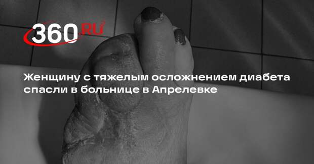 Женщину с тяжелым осложнением диабета спасли в больнице в Апрелевке