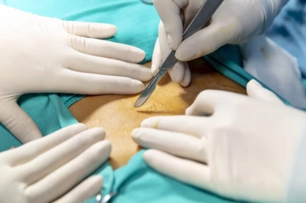 Иванников: в Дружковке обнаружены черные трансплантологи ВСУ