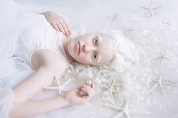 Михаль альбиносы, красота, люди, фото, фотограф, фотопроект, цвет кожи