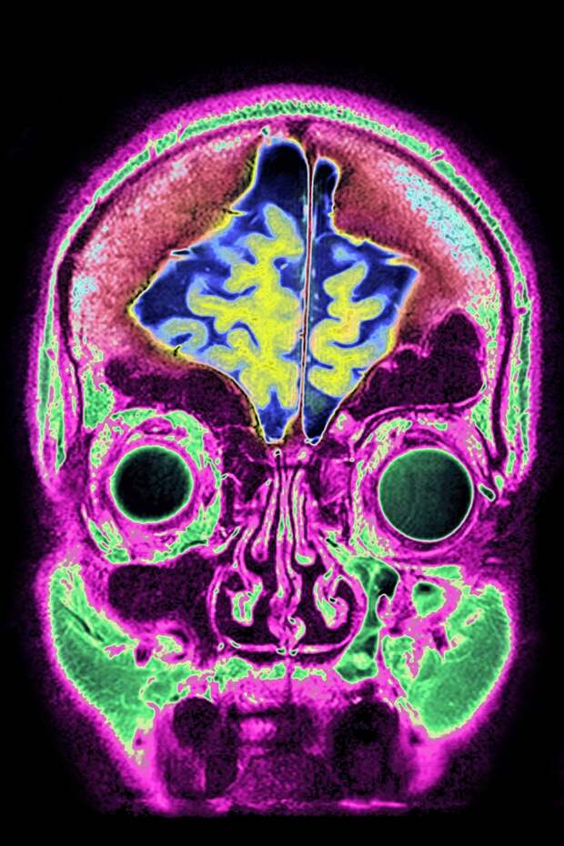 Brains 7