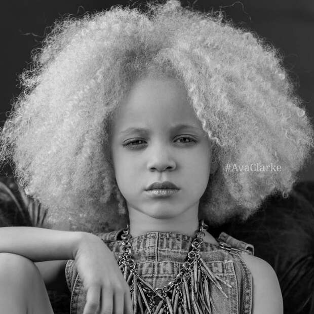 Ава Кларк – 8-летняя девочка-альбинос, ставшая юной афроамериканской моделью Ава Кларк, Ava Clarke, девочка-альбинос ставшая моделью