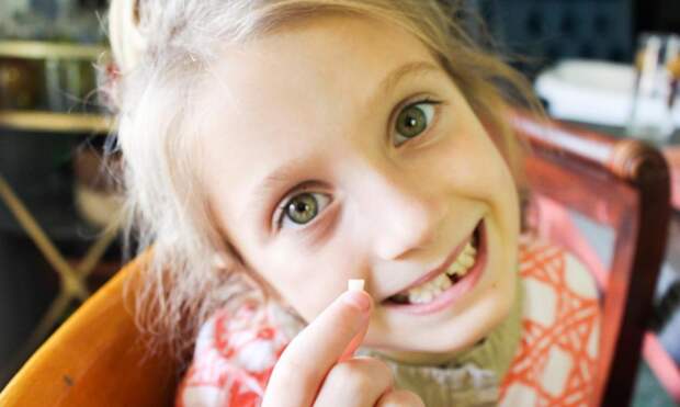 Названа причина, почему нужно хранить выпавшие молочные зубы