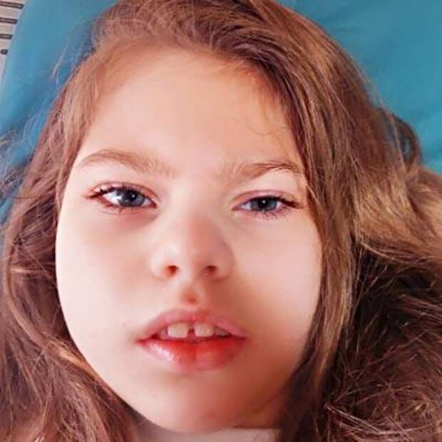 Есения Иванченко, 8 лет, детский церебральный паралич, требуется лечение, 45 375 ₽