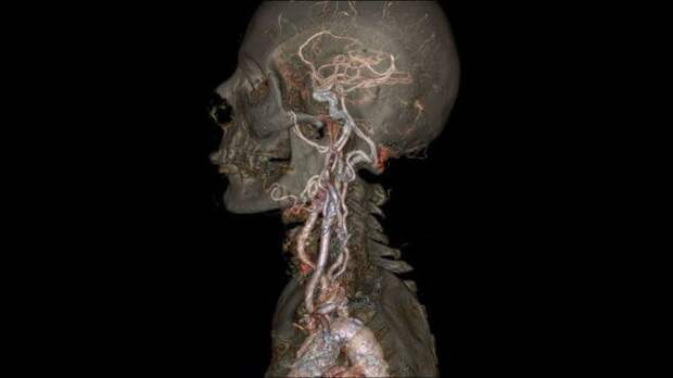 Так выглядит снимок головы человека, сделанный новейшим компьютерным томографом загадки, интересно, неизведанное, познавательно, тайны