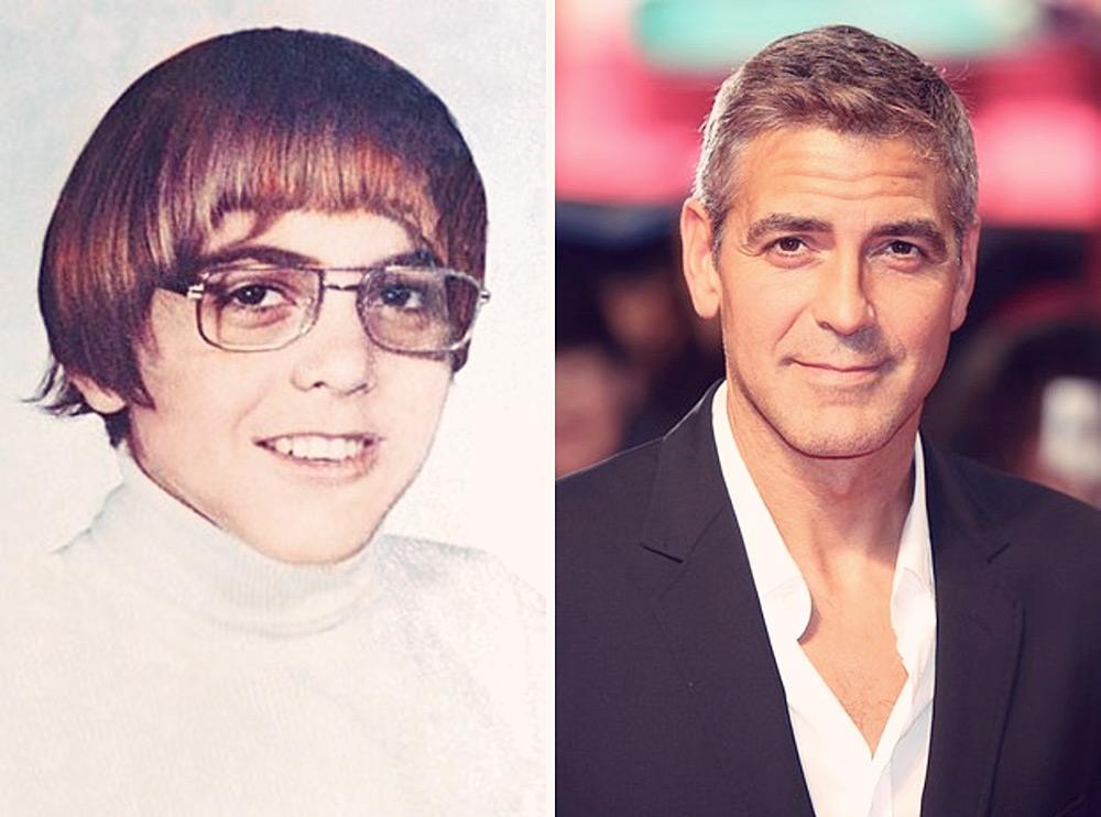 FormerlyAwkwardCelebs03 Вечно недовольны собственной внешностью? Всего 20 фото докажут, что надежда есть!