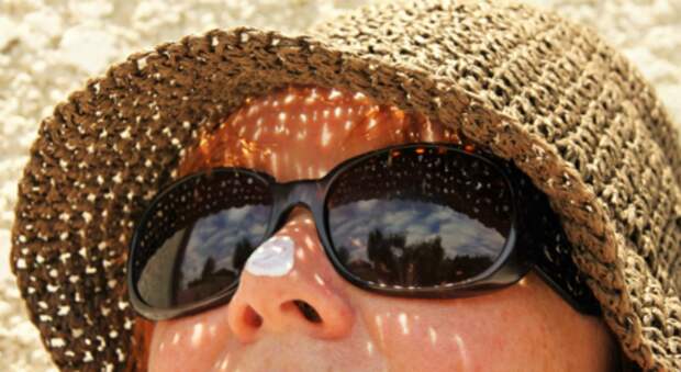 Риск рака: что будет, если не защищать кожу кремом от солнца весной