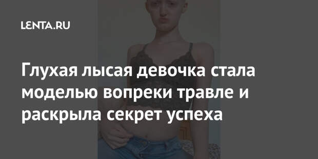 Глухая лысая девочка стала моделью вопреки травле и раскрыла секрет успеха