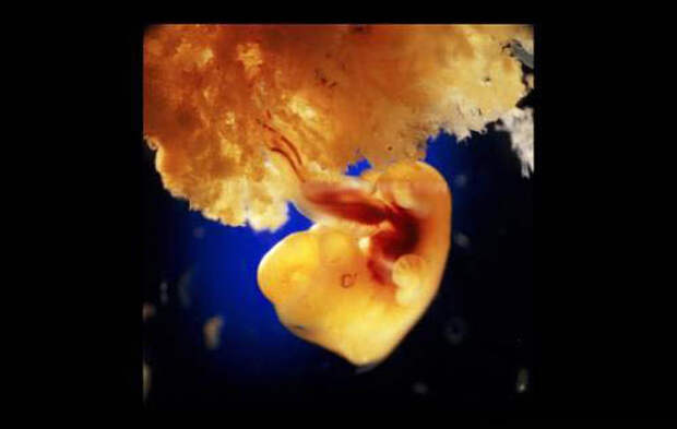 Рождение новой жизни в фотографиях