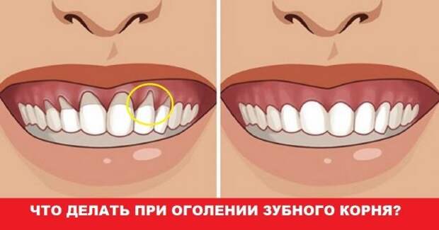 thumb-600x315-1-3