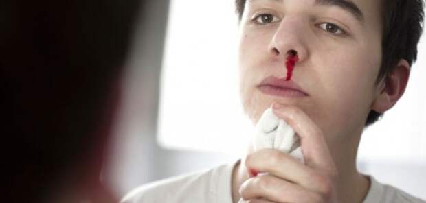 О чём могут предупредить частые носовые кровотечения, выяснили эксперты