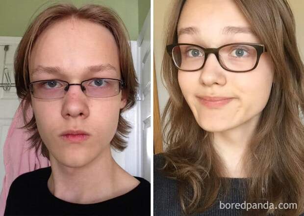 16-Year-Old Male To Female, From 2 Months Before I Realized I Was Trans To 1 Year On HRT