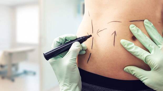 Mash: Ученый из Уфы обвинил США в краже технологии по увеличению ягодиц