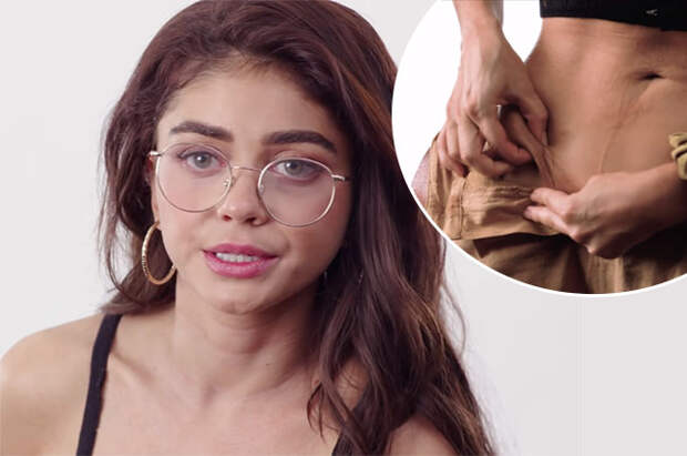 Актриса Сара Хайленд перенесла вторую пересадку почки