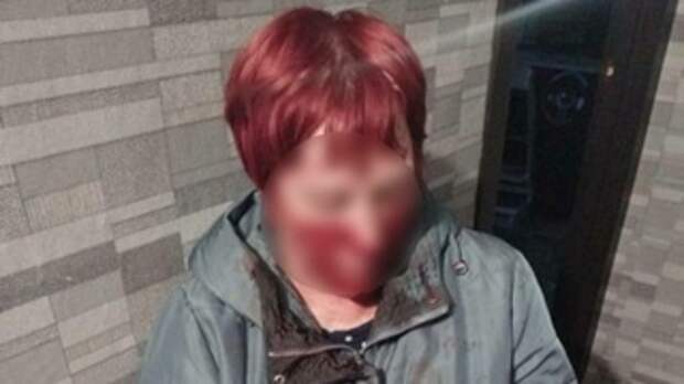 Женщину избили в Новоалтайске / Фото: