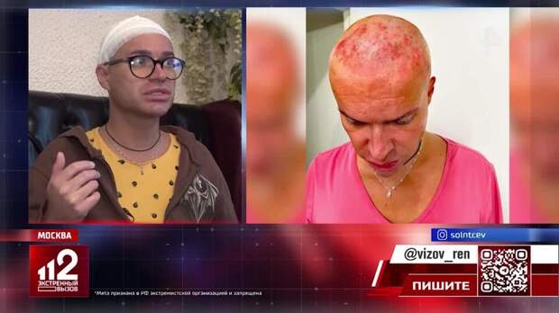 Гогена Солнцева изуродовали в парикмахерской в Москве