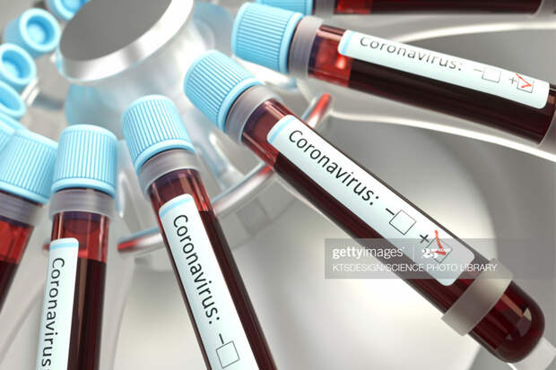 Corona-Test Corona-Test