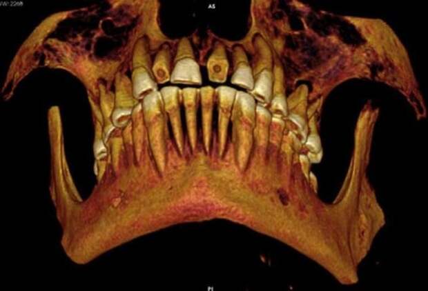 Следы древней стоматологии.
