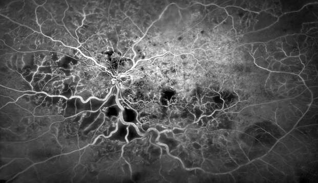 Победители конкурса фотографии в области биомедицины Wellcome Image Awards 2016