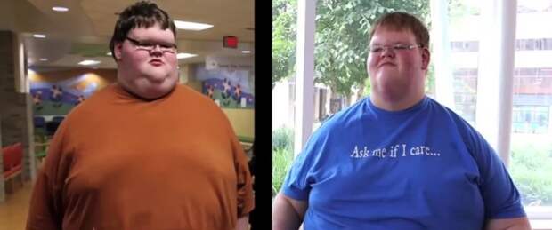 В свои 15 лет этот мальчик весил 321 килограмм... Только посмотри, как он выглядит сейчас!