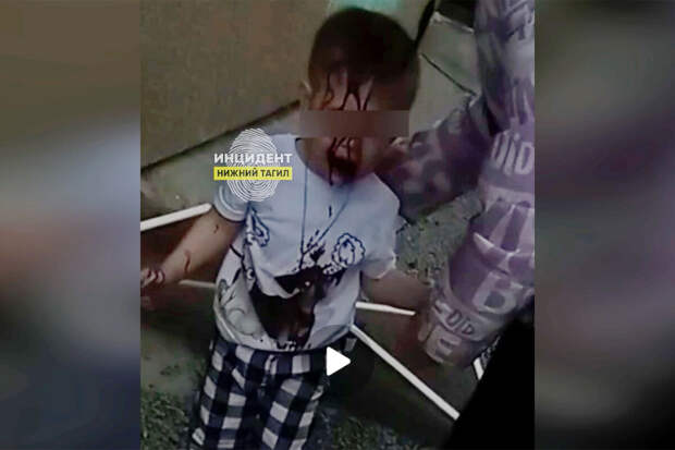 В Нижнем Тагиле дошкольник выпал из окна и пробил голову о бетон
