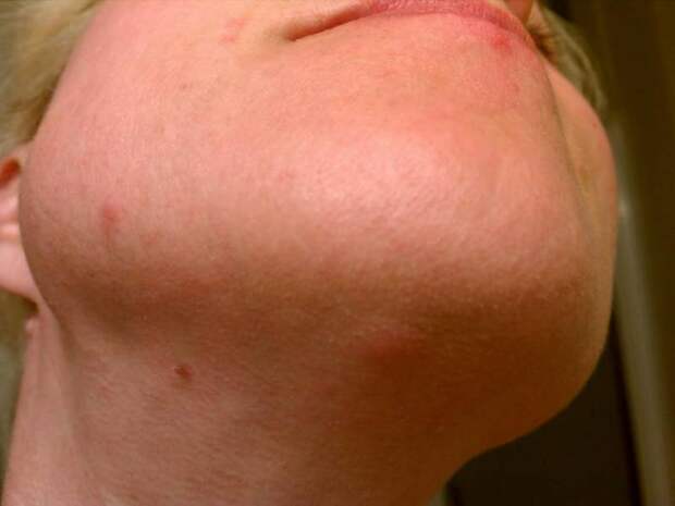 Болит подбородок: возможные причины, диагностика