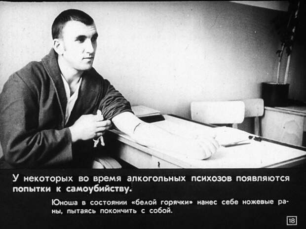 Алкоголизм и борьба с ним. Диафильм