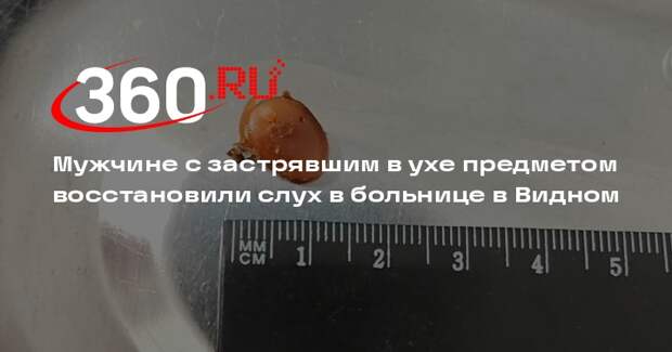 Мужчине с застрявшим в ухе предметом восстановили слух в больнице в Видном