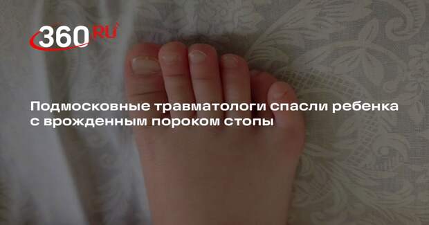 Подмосковные травматологи спасли ребенка с врожденным пороком стопы