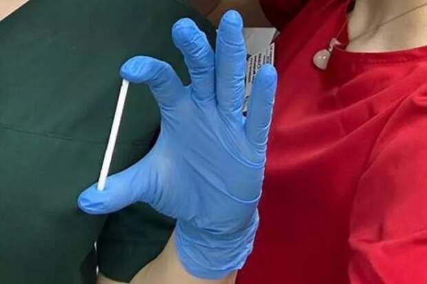 В Новороссийске школьник проглотил чупа-чупс: палочка застряла в животе