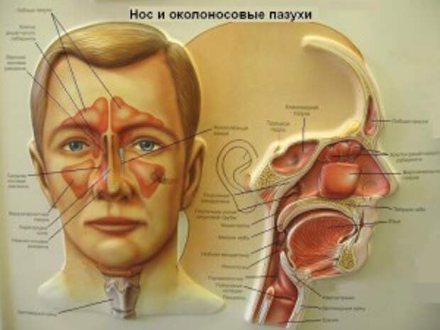 Гайморит