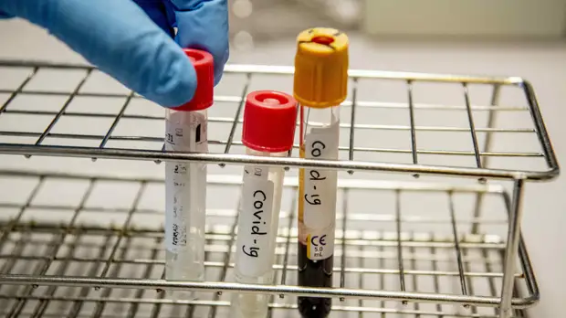 Число выявленных случаев коронавируса в Подмосковье превысило тысячу