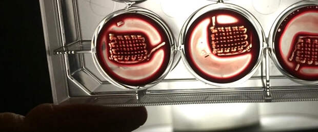 Импланты из крови восстанавливают сломанные кости