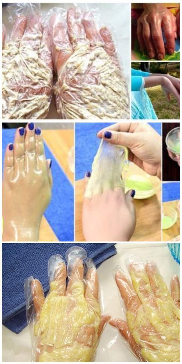 Чудо-маска от трещин на руках (с омолаживающим эффектом) кожа рук становится мягкой, эластичной и трещины проходят буквально за 3-4 дня