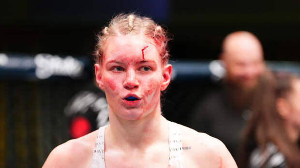 Экс-боец UFC Дудакова успешно перенесла операцию