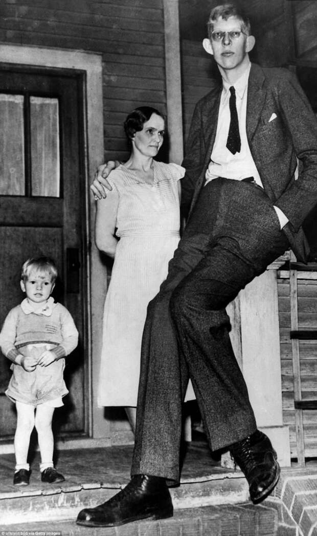 Роберт в возрасте 17 лет, с матерью и братом, 1935 г. акромегалия, великан, опухоль, рекорд, рекорд гиннесса, рекордсмен Гинесса, самый высокий, самый высокий человек