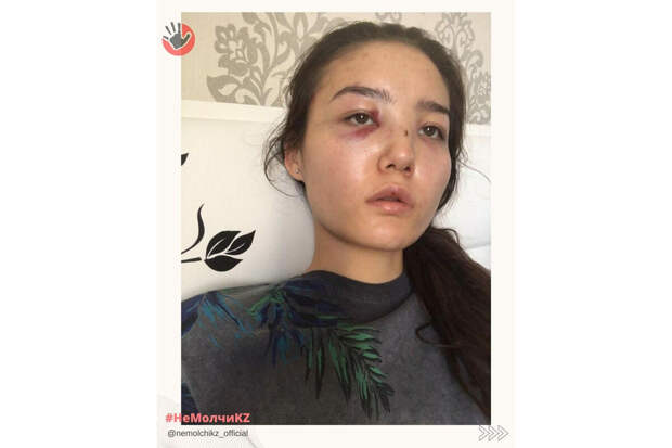 Жена сотрудника МИД Казахстана обвинила его в избиениях ее и ее сестры