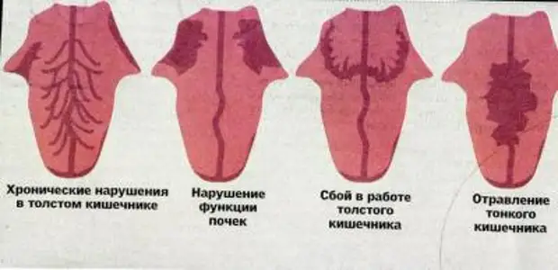 Диагностика по языку в картинках болезней человека цвету