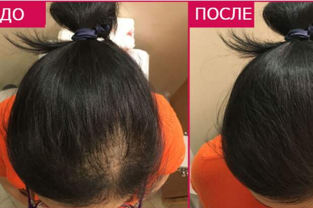 12 простых бьюти-лайфхаков на разные случаи жизни