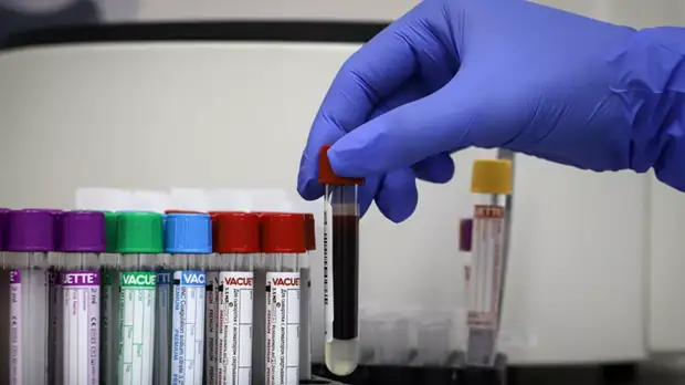 Чепик: по приезде на базу у всех возьмут анализы на наличие коронавируса